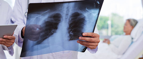 Урсодезоксихолевая кислота облегчает повреждение лёгких, вызванное сепсисом